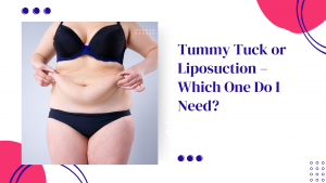 Tummy Tuck or Liposuction – Which One Do I Need?