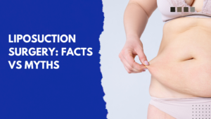 Liposuction Surgery Facts vs Myths