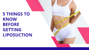 5 things to know before getting liposuction