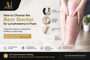 Best Doctor for Lymphedema in Pune - Dr Amit Mulay providing advanced lymphedema treatment, expert consultation, and personalized care for persistent arm and leg swelling in Pune.