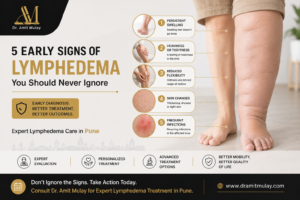 5 Early Signs of Lymphedema You Should Never Ignore - Dr Amit Mulay Pune offering expert diagnosis and advanced lymphedema treatment.