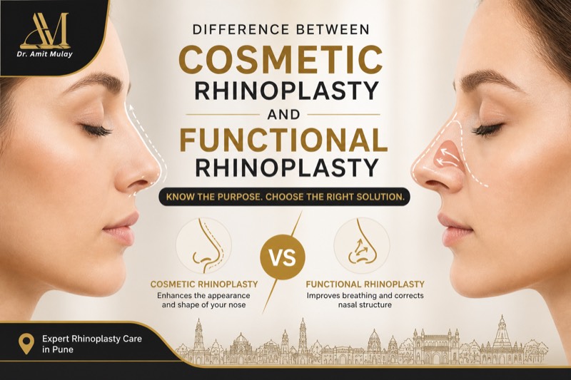 Rhinoplasty