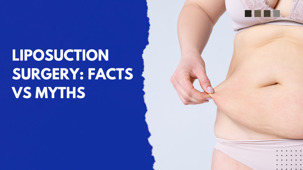 Liposuction Surgery Facts vs Myths