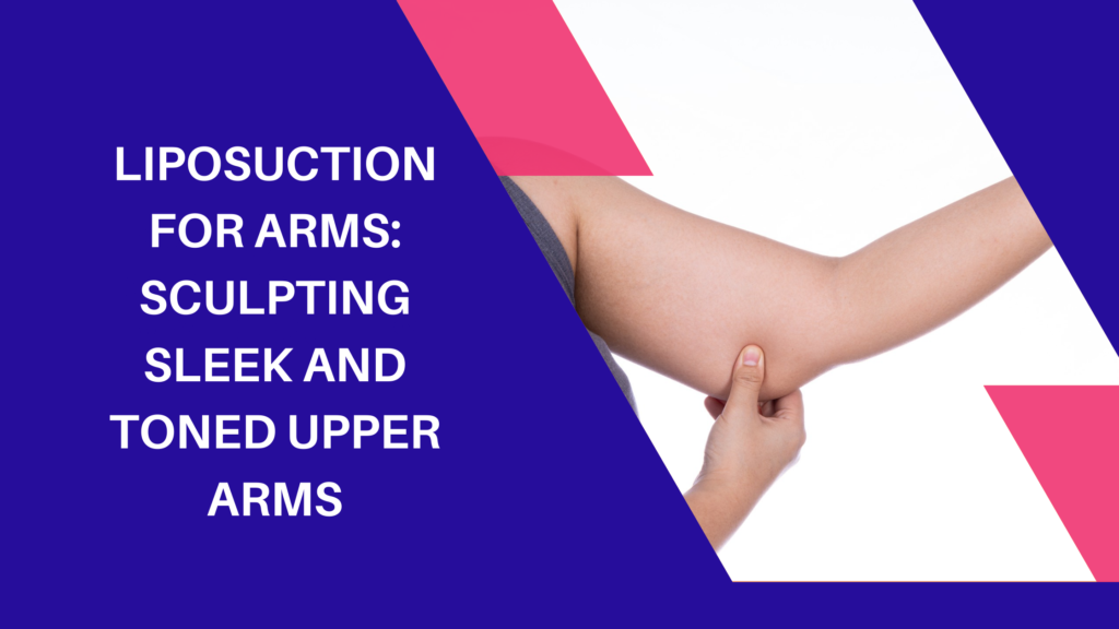 Liposuction for Arms: Sculpting Sleek and Toned Upper Arms