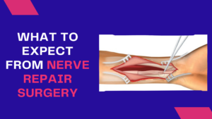 Nerve repair surgery