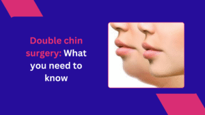 Double chin surgery