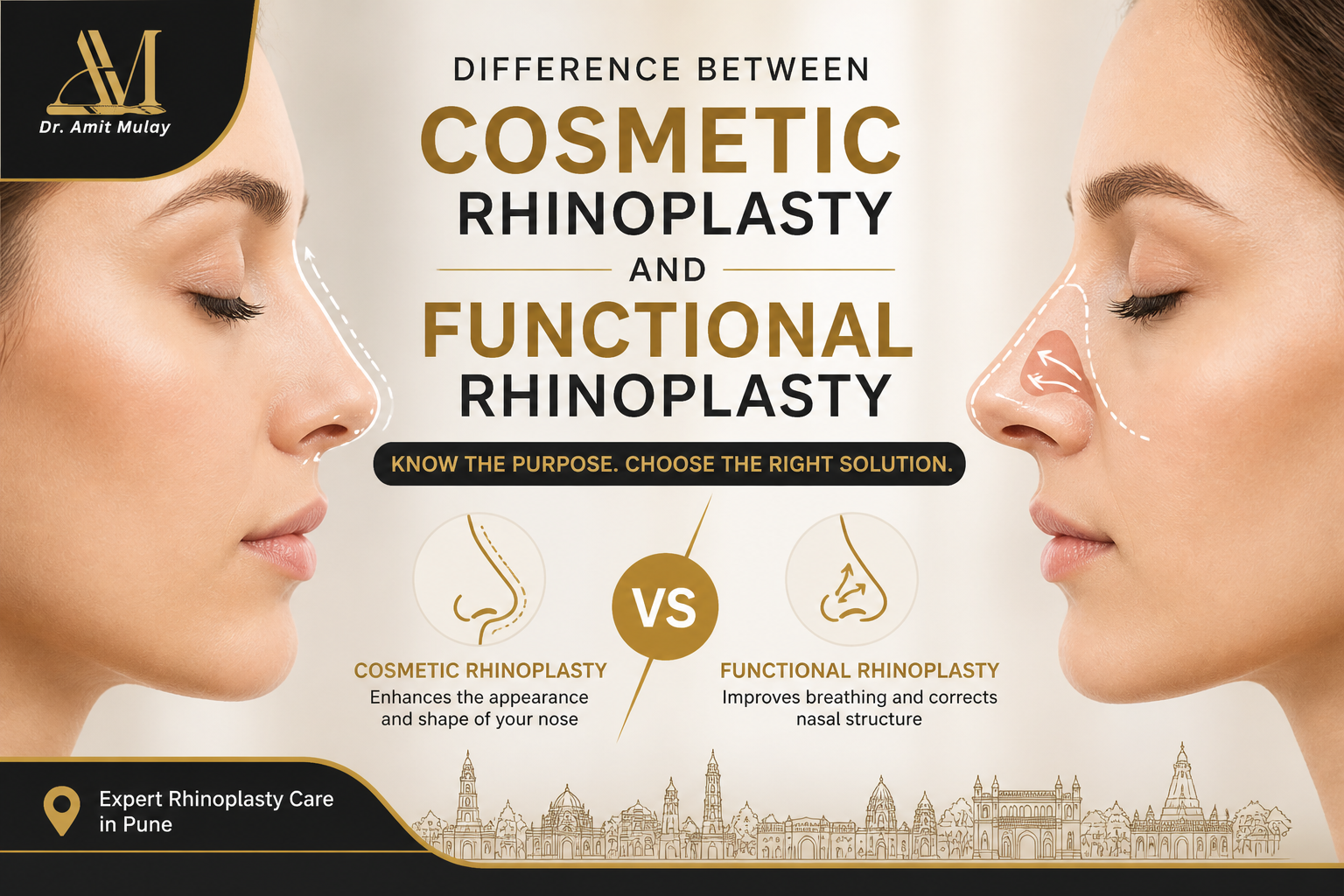 Professional featured image comparing cosmetic rhinoplasty and functional rhinoplasty with side-profile illustrations of a woman’s nose, medical comparison icons, gold and black premium design theme, Pune city skyline artwork, and Dr. Amit Mulay logo branding for rhinoplasty treatment in Pune.