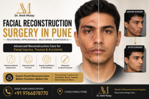 Featured image for facial reconstruction surgery in Pune showing before-and-after facial trauma recovery, advanced reconstructive surgery treatment, facial injury correction, confidence restoration, Dr. Amit Mulay branding, consultation number, and expert reconstructive care in Chinchwad, Pune.