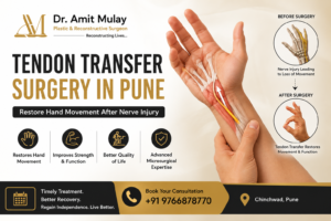 Featured image for tendon transfer surgery in Pune showing anatomical hand reconstruction, before-and-after nerve injury recovery illustration, benefits of reconstructive microsurgery, Dr. Amit Mulay branding, consultation number, and advanced hand surgery care in Chinchwad, Pune.