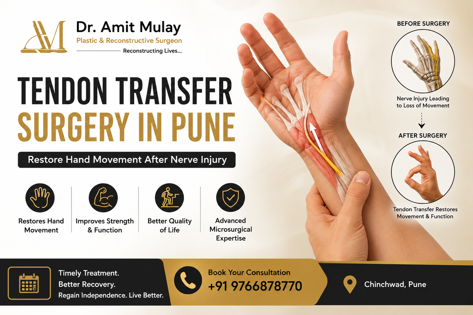 Featured image for tendon transfer surgery in Pune showing anatomical hand reconstruction, before-and-after nerve injury recovery illustration, benefits of reconstructive microsurgery, Dr. Amit Mulay branding, consultation number, and advanced hand surgery care in Chinchwad, Pune.