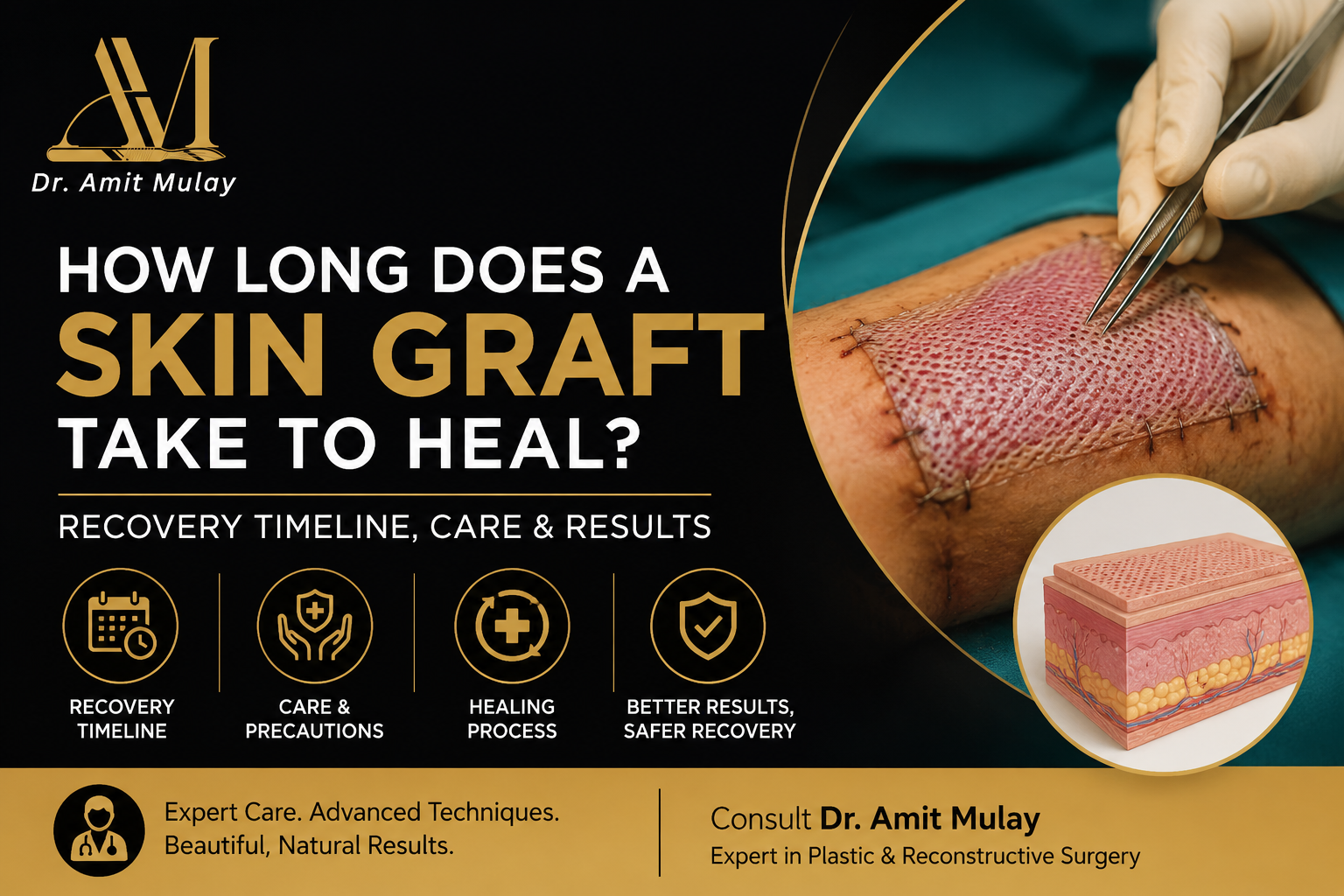 "Professional medical infographic by Dr. Amit Mulay explaining skin graft recovery, featuring a skin graft surgery procedure, healing timeline, recovery care tips, treatment outcomes, and reconstructive plastic surgery information in a premium black and gold design.